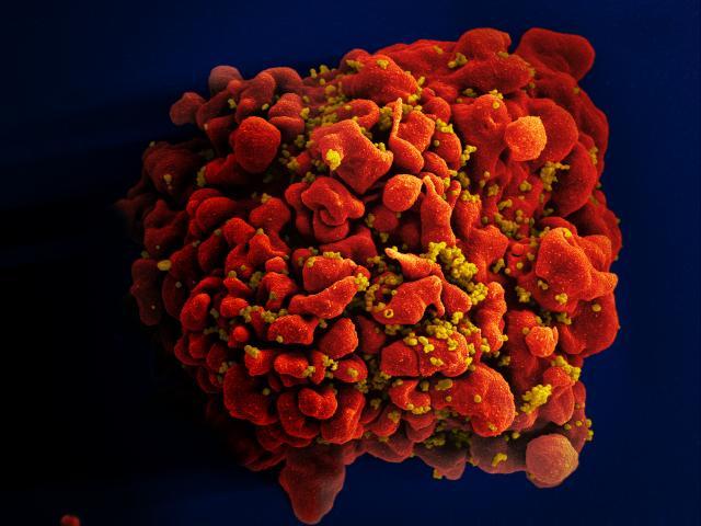 20220314-hiv.jpg HIV-infected H9 T Cell
